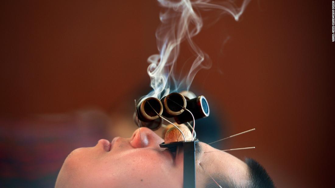 ოკულომოტორული პარალიზის ტრადიციული ჩინური მკურნალობა: კაკლის სათვალეები